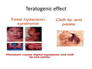 Teratogenic effect
 