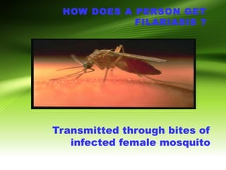 HOW DOES A PERSON GET
FILARIASIS ?
Transmitted through bites of
infected female mosquito
 
