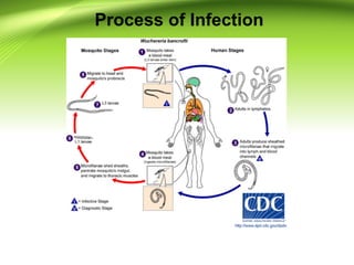 Process of Infection
 