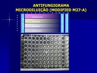 ANTIFUNGIGRAMA
MICRODILUIÇÃO (MODIFIED M27-A)
     1                2   3       4     5      6   7   8   9   10             11                  12




                                                                                             Controle de crescimento
A




                                                                    Controle - antifúngico
B                             Anfotericina B



    Controle - meio
C
D                             Fluconazol
E
F                             Itraconazol
G
H                             Cetoconazol
 