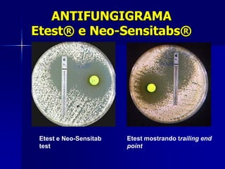 ANTIFUNGIGRAMA
Etest® e Neo-Sensitabs®




 Etest e Neo-Sensitab   Etest mostrando trailing end
 test                   point
 