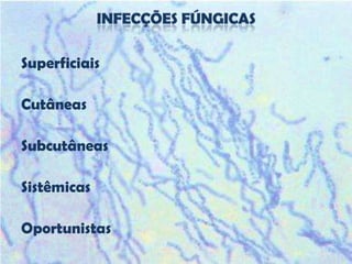 Superficiais

Cutâneas

Subcutâneas

Sistêmicas

Oportunistas
 