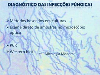 Métodos baseados em culturas
Exame direto de amostras no microscópio
 óptico

PCR
Western blot      Micologia Moderna
 