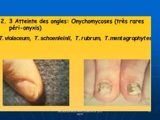 DR DIDOUH MOSTAFA COURS IFCS 2012
ANTIF
10
 