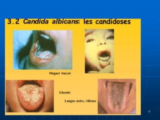 DR DIDOUH MOSTAFA COURS IFCS 2012
ANTIF
12
 