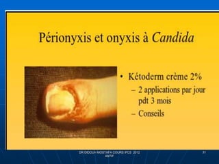 DR DIDOUH MOSTAFA COURS IFCS 2012
ANTIF
31
 