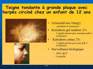 DR DIDOUH MOSTAFA COURS IFCS 2012
ANTIF
32
 