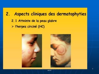 DR DIDOUH MOSTAFA COURS IFCS 2012
ANTIF
5
 