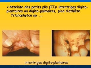 DR DIDOUH MOSTAFA COURS IFCS 2012
ANTIF
6
 