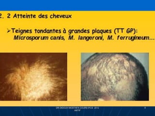 DR DIDOUH MOSTAFA COURS IFCS 2012
ANTIF
8
 