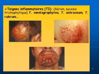 DR DIDOUH MOSTAFA COURS IFCS 2012
ANTIF
9
 