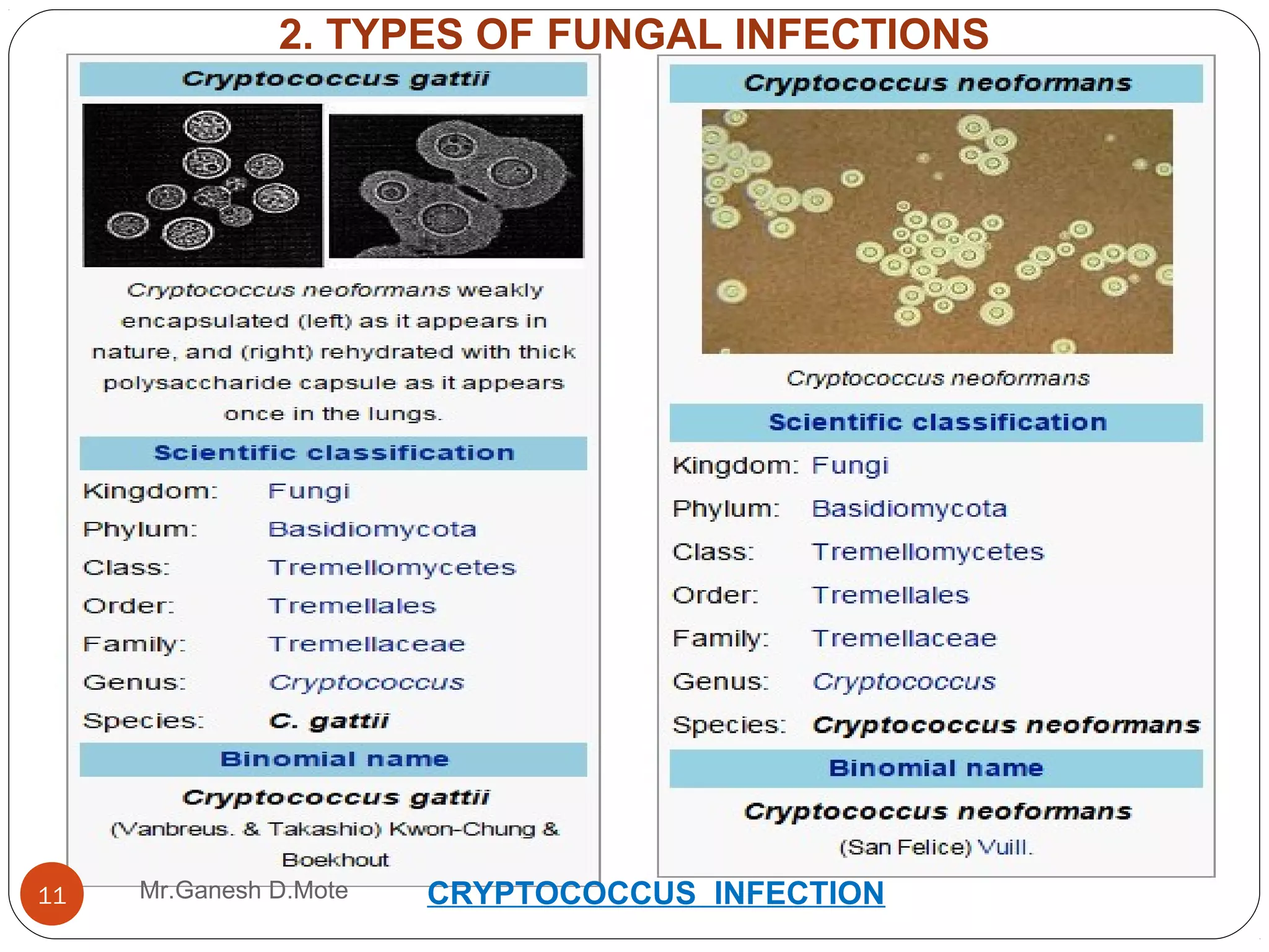 Medicinal chemistry of Antifungal agents | PPT
