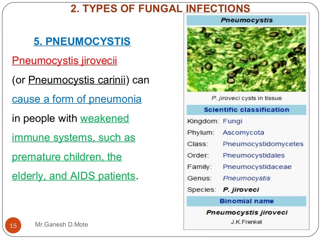 Medicinal chemistry of Antifungal agents