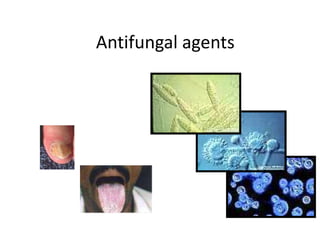 Antifungal agents
 