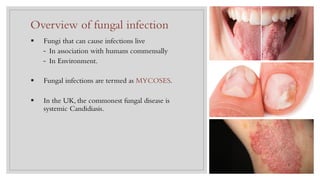 § Fungi that can cause infections live
⎯ In association with humans commensally
⎯ In Environment.
§ Fungal infections are termed as MYCOSES.
§ In the UK, the commonest fungal disease is
systemic Candidiasis.
Overview of fungal infection
3
 