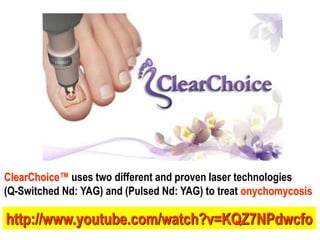 ClearChoice™ uses two different and proven laser technologies
(Q-Switched Nd: YAG) and (Pulsed Nd: YAG) to treat onychomycosis
http://www.youtube.com/watch?v=KQZ7NPdwcfo
 
