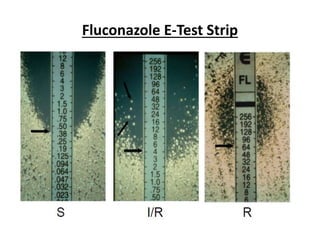 Fluconazole E-Test Strip
 