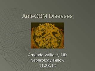 Anti-GBM Diseases




  Amanda Valliant, MD
   Nephrology Fellow
       11.28.12
 
