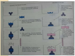 Antigen  antibody for bph class