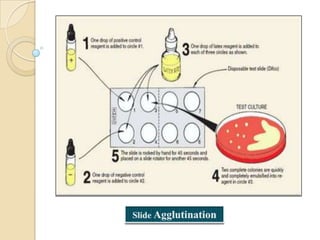 Antigen and antibody reaction | PPTX