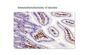 Immunohistochemistry of intestine
 