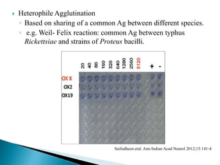  Heterophile Agglutination
◦ Based on sharing of a common Ag between different species.
◦ e.g. Weil- Felix reaction: common Ag between typhus
Rickettsiae and strains of Proteus bacilli.
Saifudheen etal. Ann Indian Acad Neurol 2012;15:141-4
 