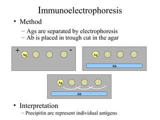 Immunoelectrophoresis
• Method
– Ags are separated by electrophoresis
• Interpretation
– Precipitin arc represent individual antigens
Ag
-+
Ag
Ab
Ag
Ab
– Ab is placed in trough cut in the agar
 