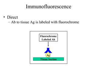 Immunofluorescence
• Direct
– Ab to tissue Ag is labeled with fluorochrome
Ag
Fluorochrome
Labeled Ab
Tissue Section
 