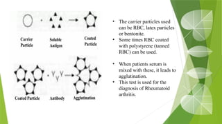 • The carrier particles used
can be RBC, latex particles
or bentonite.
• Some times RBC coated
with polystyrene (tanned
RBC) can be used.
• When patients serum is
mixed with these, it leads to
agglutination.
• This test is used for the
diagnosis of Rheumatoid
arthritis.
 