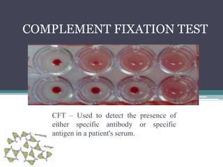COMPLEMENT FIXATION TEST 
CFT ‒ Used to detect the presence of 
either specific antibody or specific 
antigen in a patient's serum. 
 