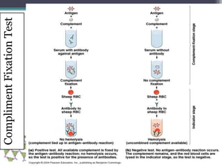 Compliment Fixation Test 
 