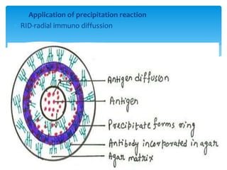 Application of precipitation reaction
 RID-radial immuno diffussion
 
