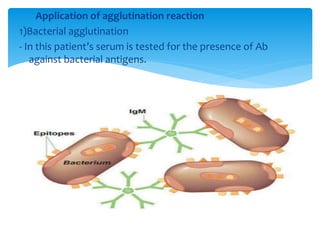 Application of agglutination reaction
1)Bacterial agglutination
- In this patient’s serum is tested for the presence of Ab
against bacterial antigens.
 