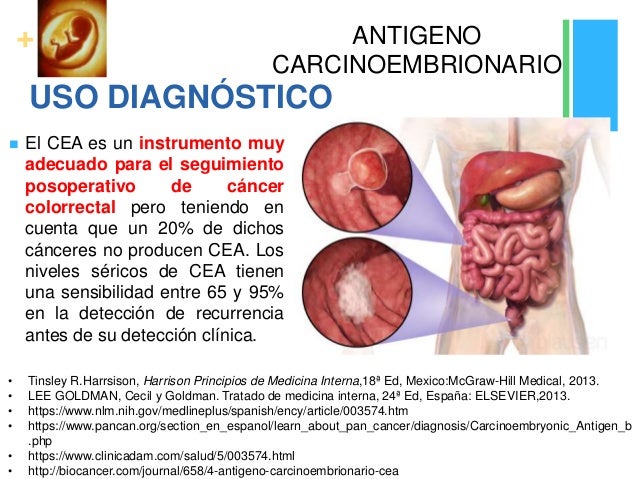 Antigeno carcinoembrionario