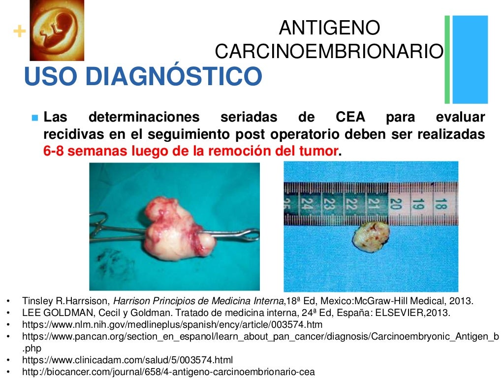 Antigeno carcinoembrionario