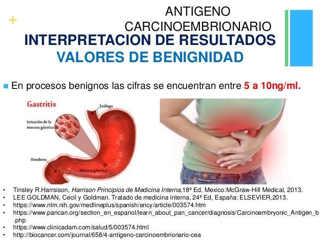 Antigeno carcinoembrionario