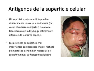 Antígenos de la superficie celular
• Otras proteínas de superficie pueden
desencadenar una respuesta inmune (tal
como el rechazo de injertos) cuando se
transfieren a un individuo geneticamente
diferente de la misma especie.
• Las proteínas de superficie mas
importantes que desencadenan el rechazo
de injertos se denominan moléculas del
complejo mayor de histocompatibilidad
 
