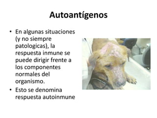 Autoantígenos
• En algunas situaciones
(y no siempre
patologicas), la
respuesta inmune se
puede dirigir frente a
los componentes
normales del
organismo.
• Esto se denomina
respuesta autoinmune
 