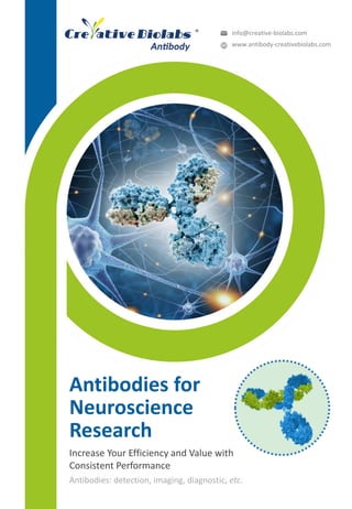Antibodies for
Neuroscience
Research
Antibodies: detection, imaging, diagnostic, etc.
Increase Your Efficiency and Value with
Consistent Performance
info@creative-biolabs.com
www.antibody-creativebiolabs.com
 
