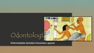 Odontología 
Enfermedades dentales frecuentes y graves 
 