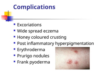 ANTI HELMINTTH AND ANTI SCABIES DRUGS.ppt