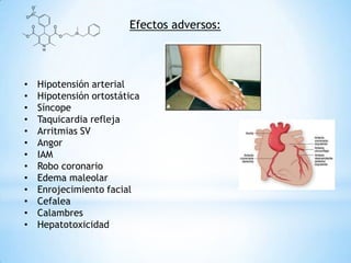 Efectos adversos:
• Hipotensión arterial
• Hipotensión ortostática
• Síncope
• Taquicardia refleja
• Arritmias SV
• Angor
• IAM
• Robo coronario
• Edema maleolar
• Enrojecimiento facial
• Cefalea
• Calambres
• Hepatotoxicidad
 