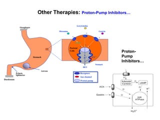 Other Therapies: Proton-Pump Inhibitors…
Proton-
Pump
Inhibitors…
Antrum
Stomach
Pyloric
Sphincter
Oesophagus
Duodenum
Histamine
Acetylcholine
Gastrin
Cck2
M3
H2
Parietal
Cells
Stomach
Proton pump
Receptors
Ion channel
cAMP
+
+
+
+
+
+
+ -
H
HCl
Cl
 