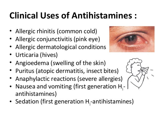 Antihistamine antihistamine