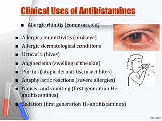 Clinical Uses of Antihistamines
■ Allergic rhinitis (common cold)
■ Allergic conjunctivitis (pink eye)
■ Allergic dermatological conditions
■ Urticaria (hives)
■ Angioedema (swelling of the skin)
■ Puritus (atopic dermatitis, insect bites)
■ Anaphylactic reactions (severe allergies)
■ Nausea and vomiting (first generation H1-
antihistamines)
■ Sedation (first generation H1-antihistamines)
 