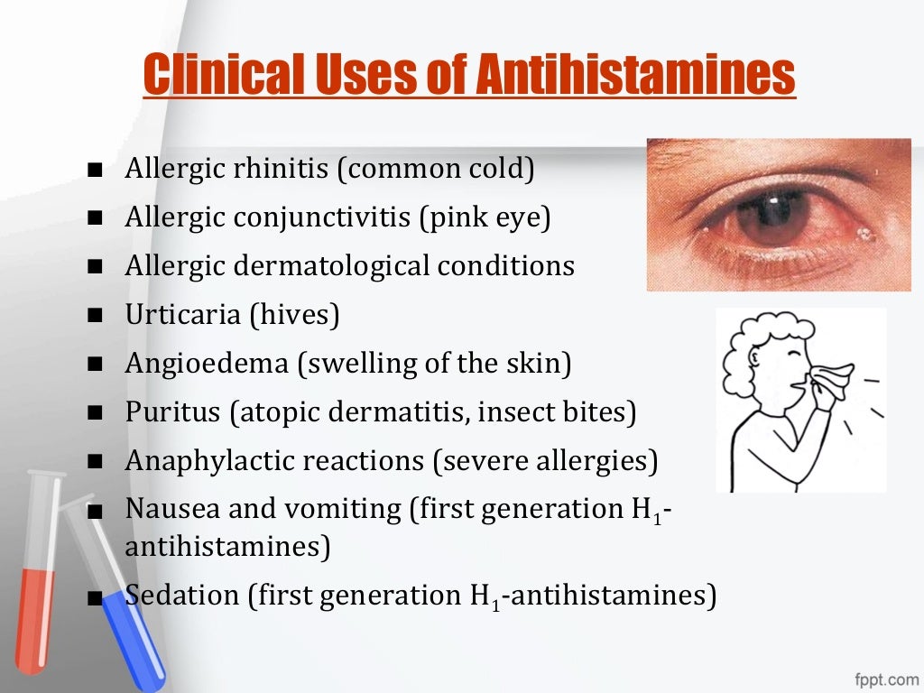 Antihistamine