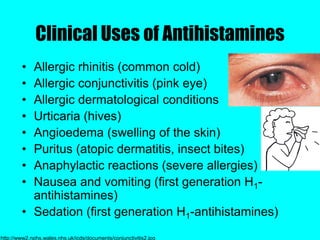 antihistamine presentation-khall.pptx