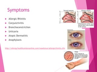 Antihistamines | PPT