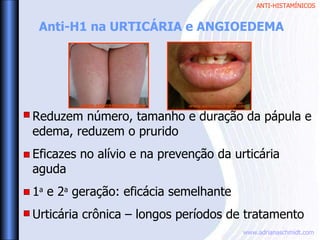 ANTI-HISTAMÍNICOS
www.adrianaschmidt.com
www.adrianaschmidt.com www.adrianaschmidt.com
Anti-H1 na URTICÁRIA e ANGIOEDEMA
Reduzem número, tamanho e duração da pápula e
edema, reduzem o prurido
Eficazes no alívio e na prevenção da urticária
aguda
1a
e 2a
geração: eficácia semelhante
Urticária crônica – longos períodos de tratamento
 