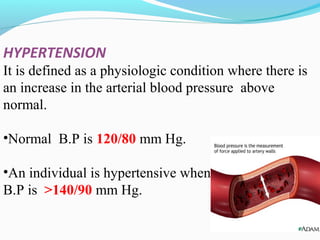 HYPERTENSION
It is defined as a physiologic condition where there is
an increase in the arterial blood pressure above
normal.
•Normal B.P is 120/80 mm Hg.
•An individual is hypertensive when
B.P is >140/90 mm Hg.
 